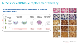 hiPSCs for cell/tissue replacement therapy
